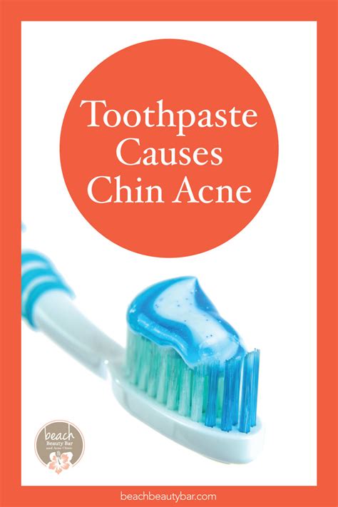 How Toothpaste Affects Acne - Beach Beauty Bar and Acne Clinic