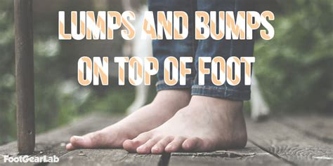 Lumps and Bumps on Top of Foot: Causes, Symptoms, and Treatment