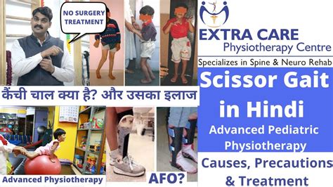 Scissor Gait explained in Hindi | Cause, Precautions & Best Treatment | Advanced Physiotherapy ...