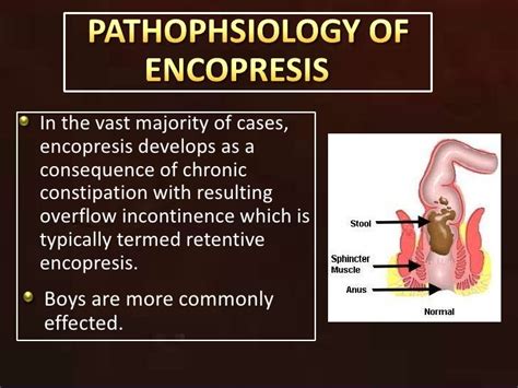 Constipation in Childrens