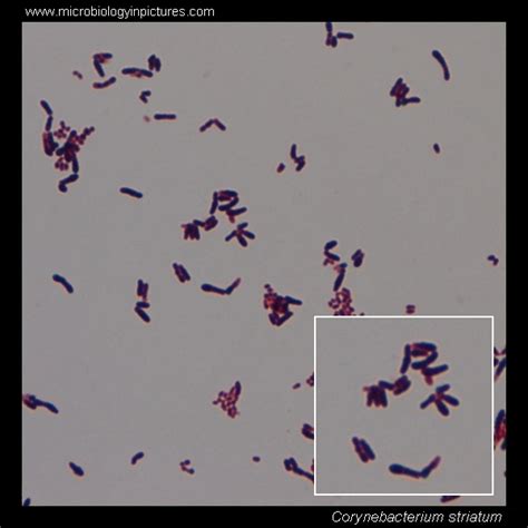 Corynebacterium striatum microscopy. Diphtheroids Gram-stained and cell morphology ...