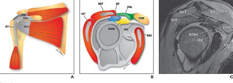 Figure 1 from The rotator interval: a review of anatomy, function, and normal and abnormal MRI ...