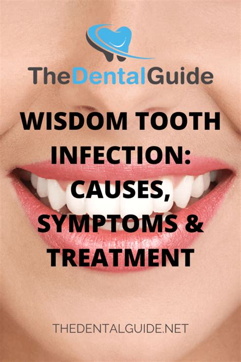 Wisdom Tooth Infection: Causes, Symptoms & Treatment - The Dental Guide