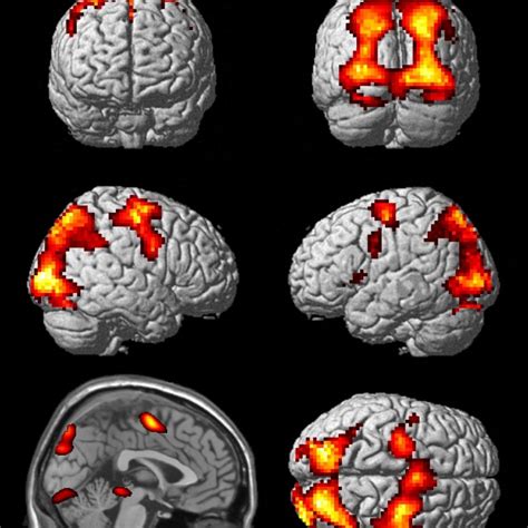 Pin by Megan Gibson on Functional MRI | Mri