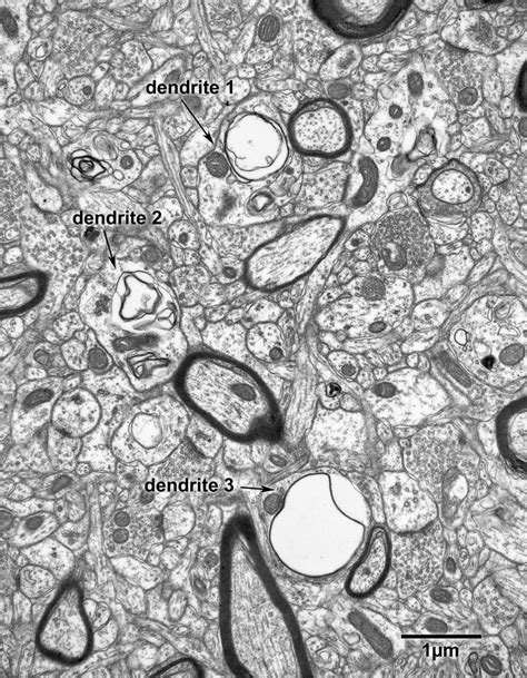 Chapter 2 – dendrites » Fine Structure of the Aging Brain | Boston University