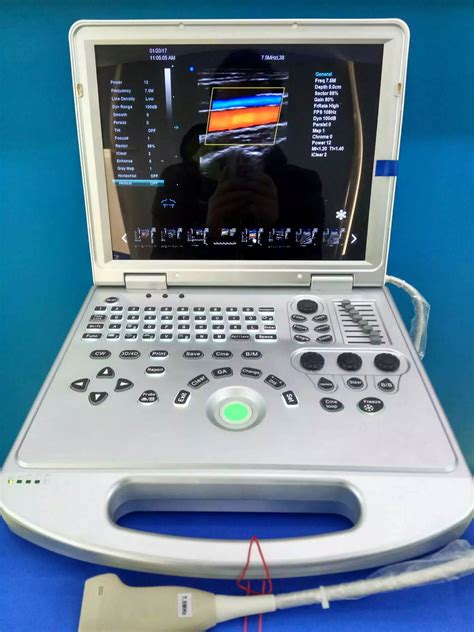 Portable color doppler ultrasound ovary | prostate machine MSLCU42 plus