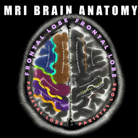 MRI brain anatomy: Axial section and central sulcus | Mohammad Irfan posted on the topic | LinkedIn