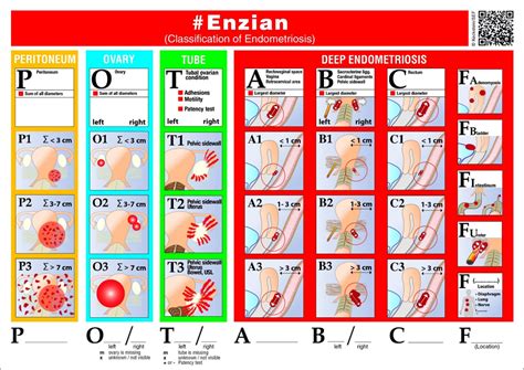 Stages of Endometriosis - EndometriosisNET