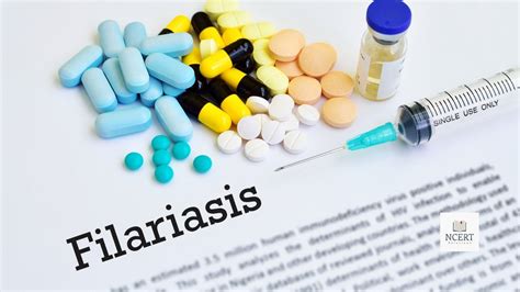 Filariasis: Symptoms and Causes - infrexa