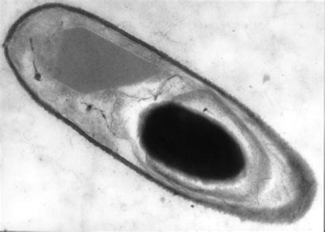 Bacterial spore turned into tiny graphene-coated cyborg - ExtremeTech