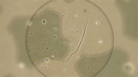 Asbestos Fibers Under Microscope