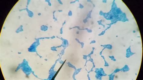 Yeast staining by Methylene blue - YouTube