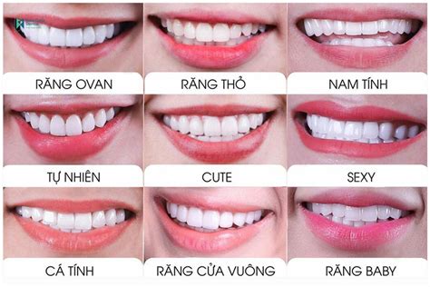 Top 10 đơn vị làm răng cửa đẹp rẻ và uy tín nhất