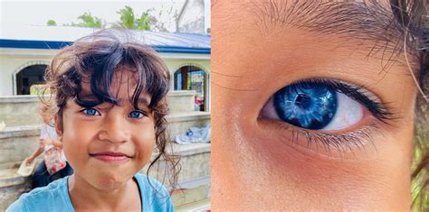 LOOK: 6-year-old blue-eyed Filipino kid with rare medical condition creates buzz on social media ...