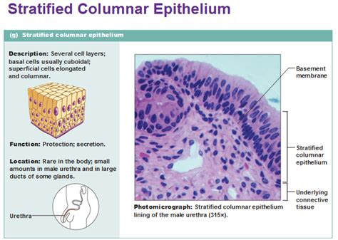 stratified columnar epithelium Skin Anatomy, Anatomy Study, Tissue Biology, Basic Anatomy And ...