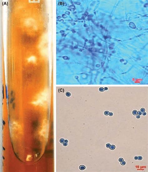 (A-C) Macro-and micromorphology of the Blastomyces dermatitidis ...