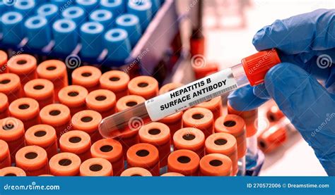 Hepatitis B Surface Antibody Test Tube with Blood Sample in Infection ...