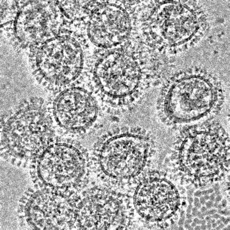 Electron Microscope Images Virus