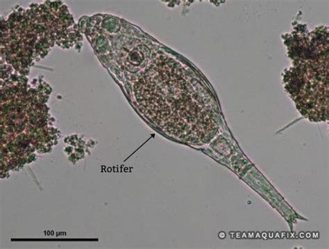 Rotifer Under A Microscope