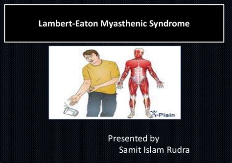 What Is Lambert Eaton;Diagnosis,Treatment And Clinical Manifestations