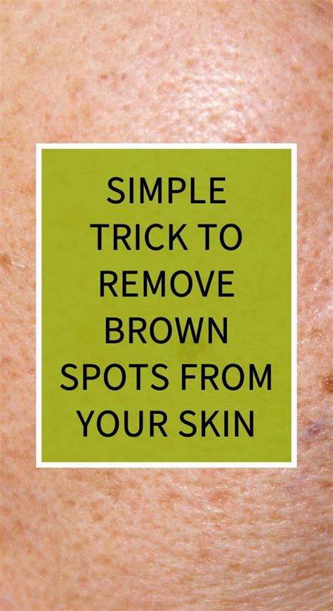 Simple Trick to Remove Brown Spots From Your Skin | Herbal cure ...