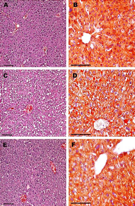 The histological evidence of steatosis in the liver of obese ...