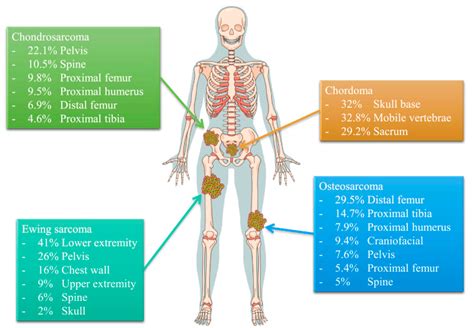 Cancers | Free Full-Text | Recent Advances in the Treatment of Bone Metastases and Primary Bone ...