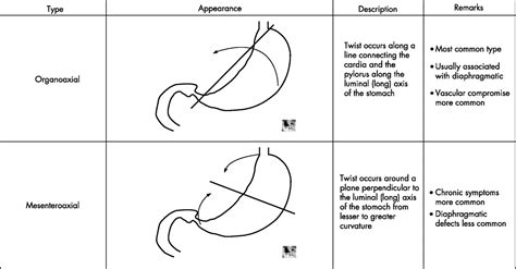 Gastric volvulus | Emergency Medicine Journal