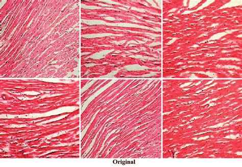 (H and E, × 400) stained microscopic section of rat heart (a) normal ...