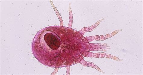 Meet Rat Mites: They’re Even Worse Than Bedbugs -- NYMag