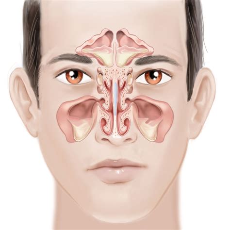 Face-with-sinus-infection - Fort Worth ENT & Sinus