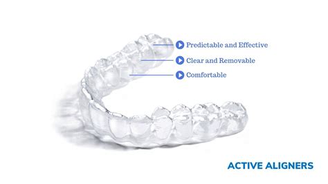 How do clear braces work - clear vs metal braces | are clear braces ...