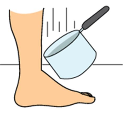 Lisfranc Injuries ← Tendonitis of Foot