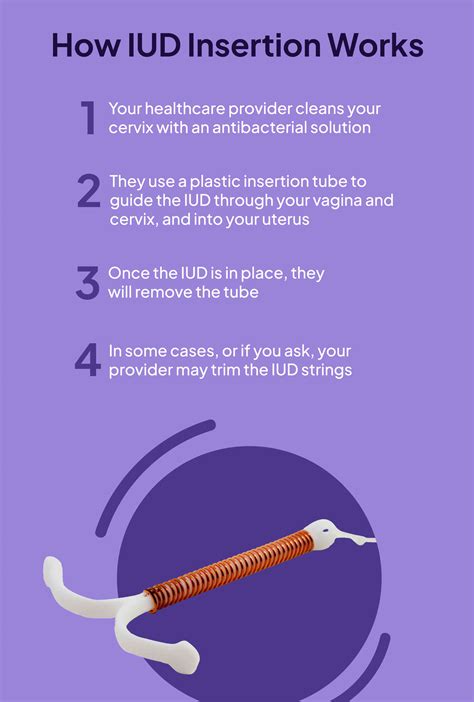 IUD Insertion: How it Works and What to Expect