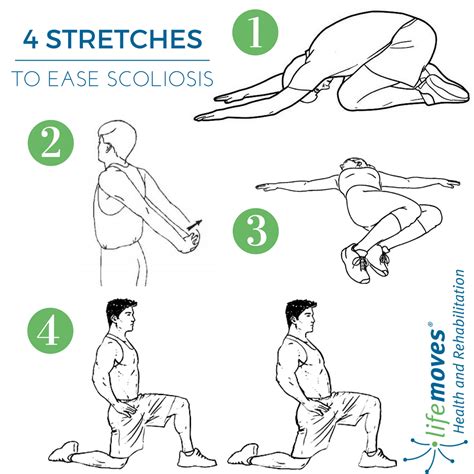 Image result for scoliosis #scoliosisexercises | Escoliose, Escoliose ...