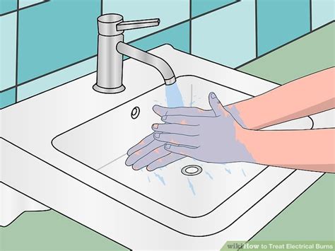 How to Treat Electrical Burns (with Pictures) - wikiHow