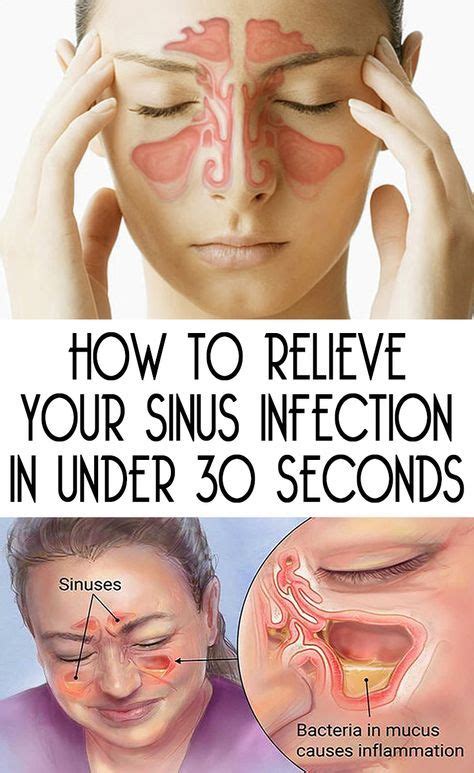 How To Relieve Your Sinus Infection In Under 30 Seconds | Sinus infection, Sinusitis, Daily ...