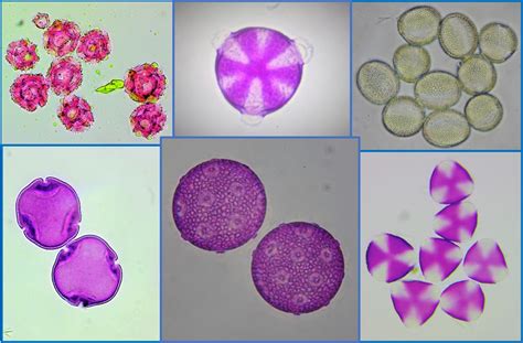 Pollen Identification Gallery for Hobby Beekeepers.