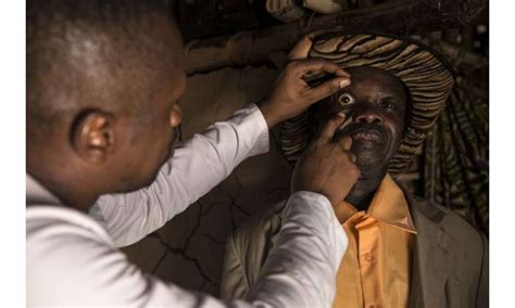 Study shows that African eye worm threatens elimination of river blindness