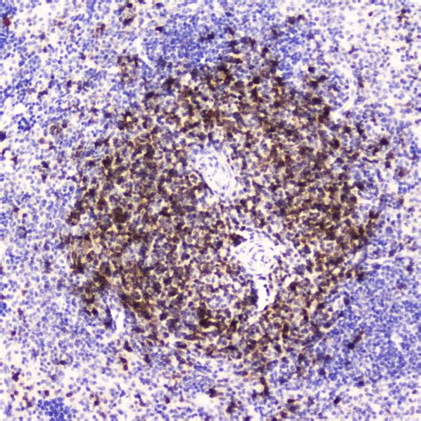 Anti-CD5 Antibody | Rabbit anti-Human Polyclonal | LSBio