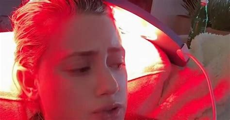 Watch: Lili Reinhart diagnosed with alopecia | Metro Video