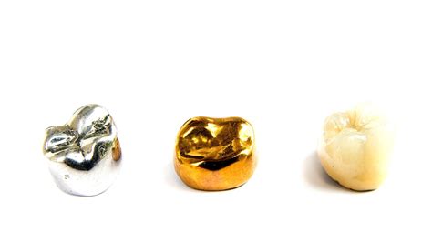 Dental Gold Crown - Gold Choices