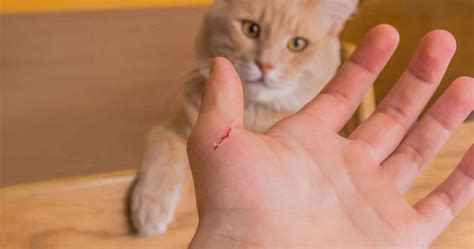 Cat scratch disease, cat scratch fever causes, symptoms, diagnosis ...