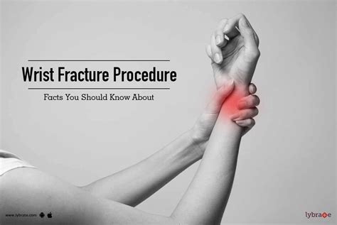 Wrist Fracture Procedure - Facts You Should Know About - By Dr. Rakesh Kumar | Lybrate