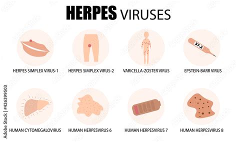 Herpes viruses. Classification, types, and symptoms of human herpes ...