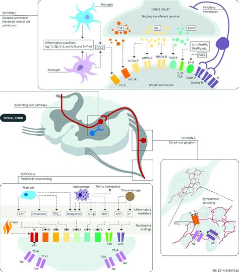 Neuropathic pain: mechanisms and their clinical implications | The BMJ