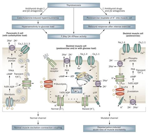 Hypokalemic Periodic Paralysis - Creative Bioarray