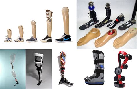 Orthotics and Prosthetics – Footorthotic