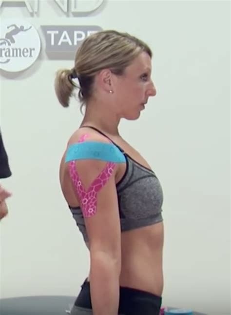 Shoulder and Deltoid Kinesiology Taping Techniques #TapeTuesday ...