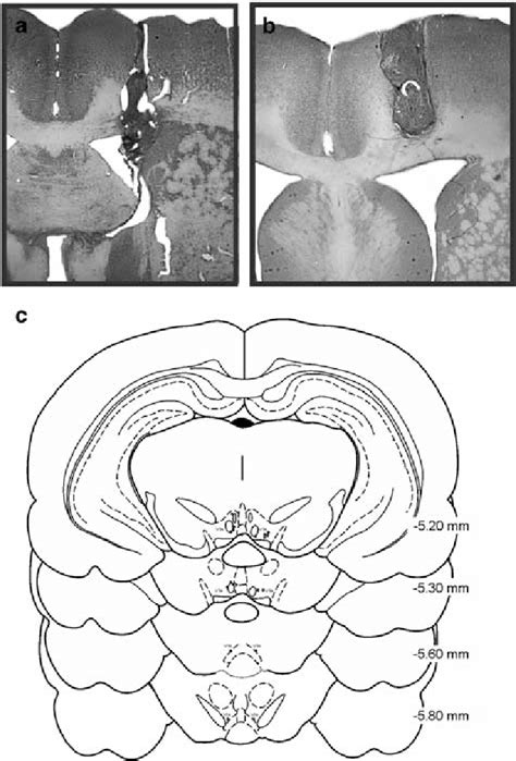 Histology. (a) Accurate unilateral lateral ventricle (ICV) cannula... | Download Scientific Diagram